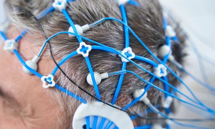 Diagnoza badająca bioelektryczną czynność mózgu: czym jest EEG? - zdjęcie