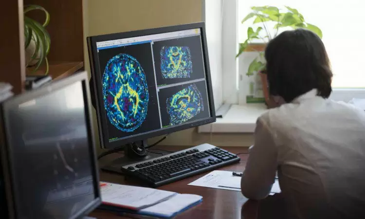 Glejak mózgu – czym jest i co trzeba o nim wiedzieć? Objawy, leczenie i rokowania po wykryciu glejaka - zdjęcie