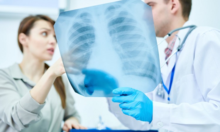 Gruźlica – przyczyny, objawy i powikłania. Diagnostyka i leczenie gruźlicy