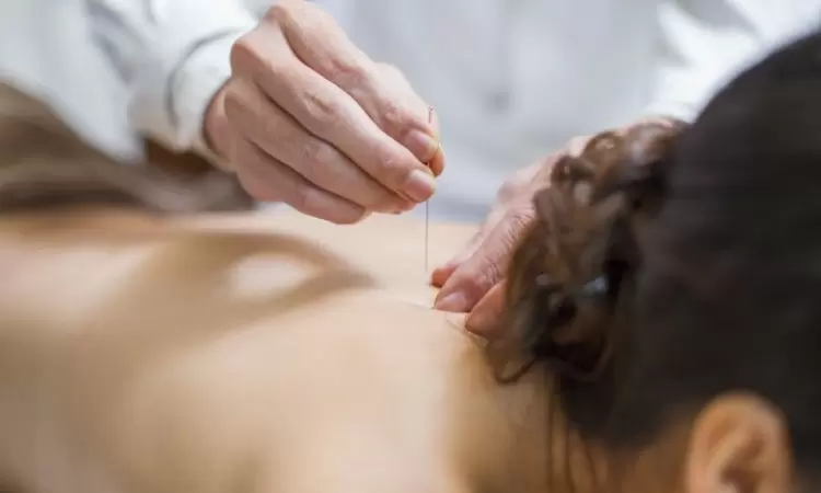 Współczesna akupunktura – co leczy? Ile kosztuje zabieg nakłuwania skóry i tkanki podskórnej? - zdjęcie
